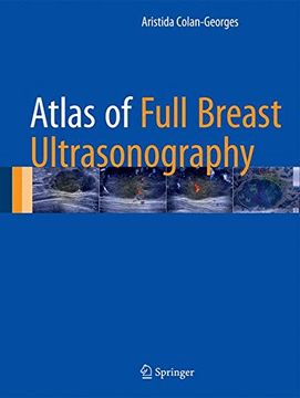 portada Atlas of Full Breast Ultrasonography (en Inglés)