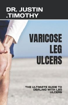 portada Varicose Leg Ulcers: The Ultimate Guide to Dealing with Leg Ulcers (in English)