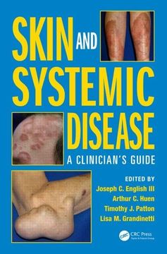 portada Skin and Systemic Disease: A Clinician's Guide (en Inglés)