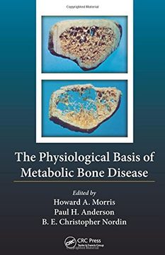 portada The Physiological Basis of Metabolic Bone Disease (en Inglés)