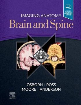 portada Imaging Anatomy Brain and Spine (in English)
