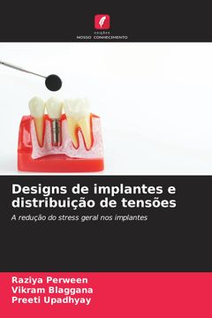 portada Designs de Implantes e Distribuição de Tensões