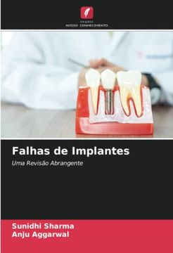 portada Falhas de Implantes: Uma Revisão Abrangente