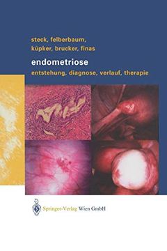 portada Endometriose: Entstehung, Diagnose, Verlauf und Therapie (en Alemán)