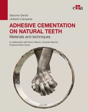 portada Adhesive Cementation on Natural Teeth. Materials and Techniques (in English)