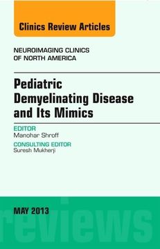 portada Pediatric Demyelinating Disease and Its Mimics, an Issue of Neuroimaging Clinics: Volume 23-2 (en Inglés)