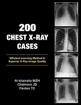 portada 200 chest x-ray cases (en Inglés)