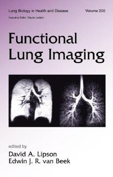 portada functional lung imaging (en Inglés)