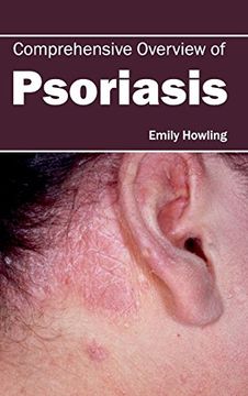 portada Comprehensive Overview of Psoriasis (en Inglés)