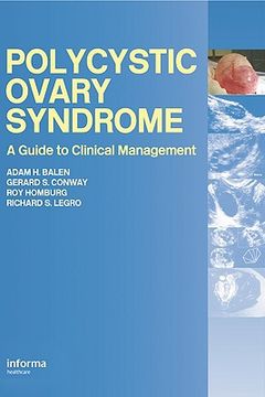 portada Polycystic Ovary Syndrome: A Guide to Clinical Management (en Inglés)