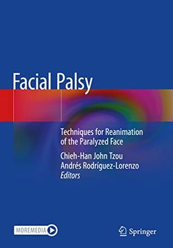 portada Facial Palsy: Techniques for Reanimation of the Paralyzed Face (in English)