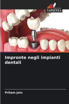 portada Impronte negli impianti dentali (in Italian)