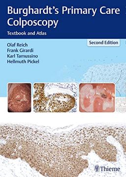 portada Burghardt's Primary Care Colposcopy: Textbook and Atlas (en Inglés)