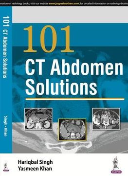 portada 101 ct Abdomen Solutions (en Inglés)