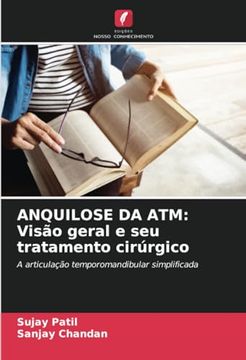 portada Anquilose da Atm: Visão Geral e seu Tratamento Cirúrgico: A Articulação Temporomandibular Simplificada (en Portugués)