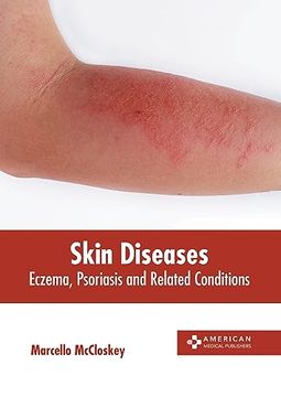 portada Skin Diseases: Eczema, Psoriasis and Related Conditions (en Inglés)