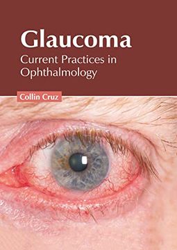 portada Glaucoma: Current Practices in Ophthalmology (en Inglés)