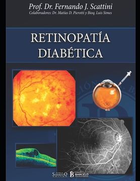 portada Retinopatía diabética: Oftalmología