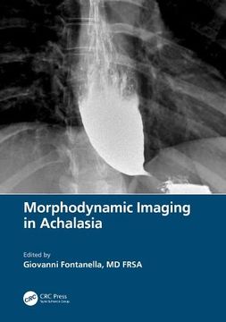 portada Morphodynamic Imaging in Achalasia 