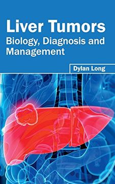 portada Liver Tumors: Biology, Diagnosis and Management 