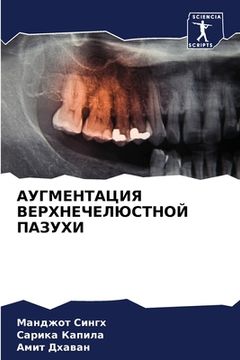 portada АУГМЕНТАЦИЯ ВЕРХНЕЧЕЛЮ&# (in Russian)
