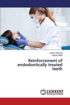 portada Reinforcement of endodontically treated teeth