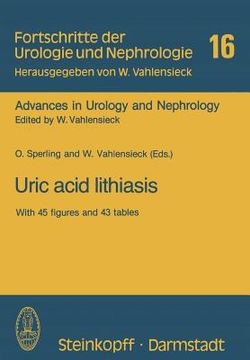 portada uric acid lithiasis: workshop tel aviv 10.-12. dezember 1980 (en Inglés)