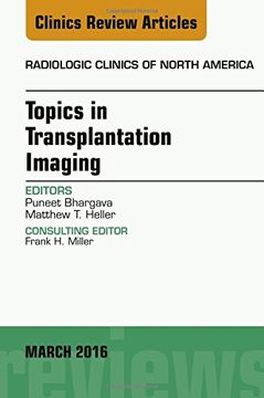portada Topics in Transplantation Imaging, An Issue of Radiologic Clinics of North America, 1e (The Clinics: Radiology)