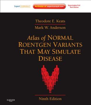 portada atlas of normal roentgen variants that may simulate disease