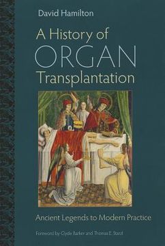portada a history of organ transplantation