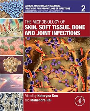portada The Microbiology of Skin, Soft Tissue, Bone and Joint Infections: Volume 2 (Clinical Microbiology Diagnosis, Treatment and Prophylaxis of Infections) (en Inglés)