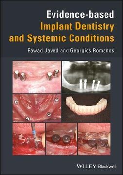 portada Evidence-Based Implant Dentistry and Systemic Conditions