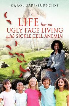 portada life has an ugly face living with sickle cell anemia! (in English)
