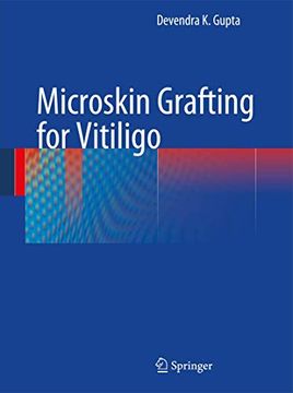 portada Microskin Grafting for Vitiligo (en Inglés)