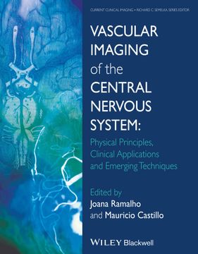 portada Vascular Imaging of the Central Nervous System: Physical Principles, Clinical Applications, and Emerging Techniques