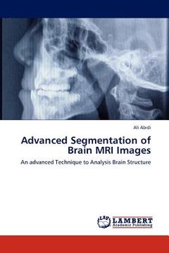 portada advanced segmentation of brain mri images (en Inglés)