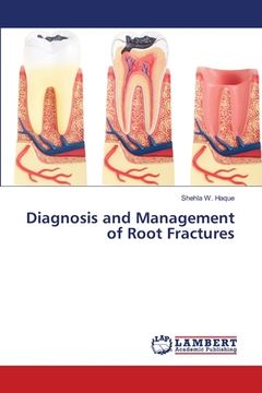 portada Diagnosis and Management of Root Fractures