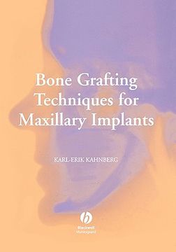 portada bone grafting techniques for maxillary implants (en Inglés)