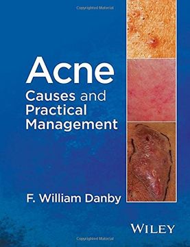 portada Acne: Causes and Practical Management