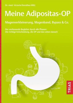 portada Meine Adipositas-Op. Magenverkleinerung, Magenband, Bypass & co. (in German)