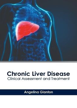 portada Chronic Liver Disease: Clinical Assessment and Treatment (in English)