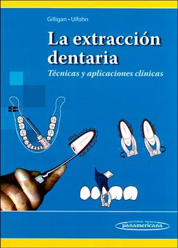 portada La Extracción Dentaria (in Spanish)