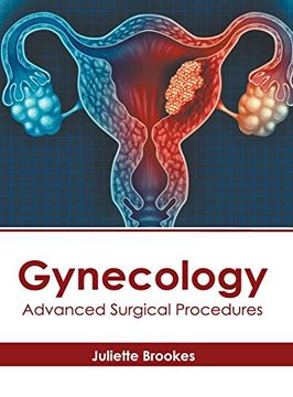 portada Gynecology: Advanced Surgical Procedures (en Inglés)