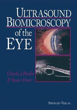 portada ultrasound biomicroscopy of the eye (en Inglés)