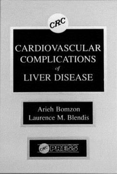 portada cardiovascular complications of liver disease (en Inglés)