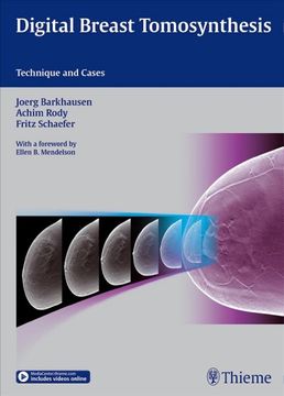 portada Digital Breast Tomosynthesis: Technique and Cases (en Inglés)