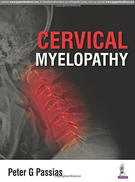 portada Cervical Myelopathy