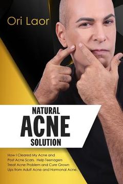 portada Natural Acne Solution: How I Cleared My Acne and Post Acne Scars. Help Teenagers Treat Acne Problem and Cure Grown Ups from Adult Acne and Ho (en Inglés)