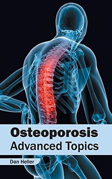 portada Osteoporosis: Advanced Topics (en Inglés)
