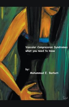Vascular Compression Syndromes - What You Need to Know (en Inglés)